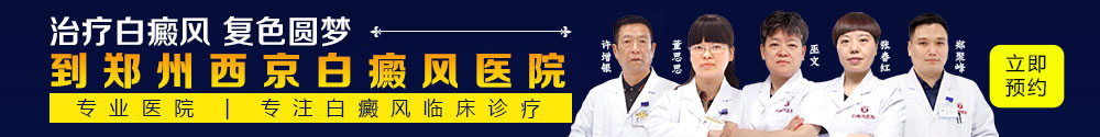 白癜风医院哪家好